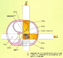 体内線量分布の比較