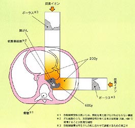 体内線量分布の比較