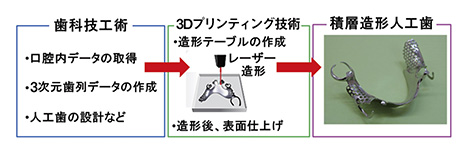 図1　3Dプリンティング技術を用いた人工歯の製造